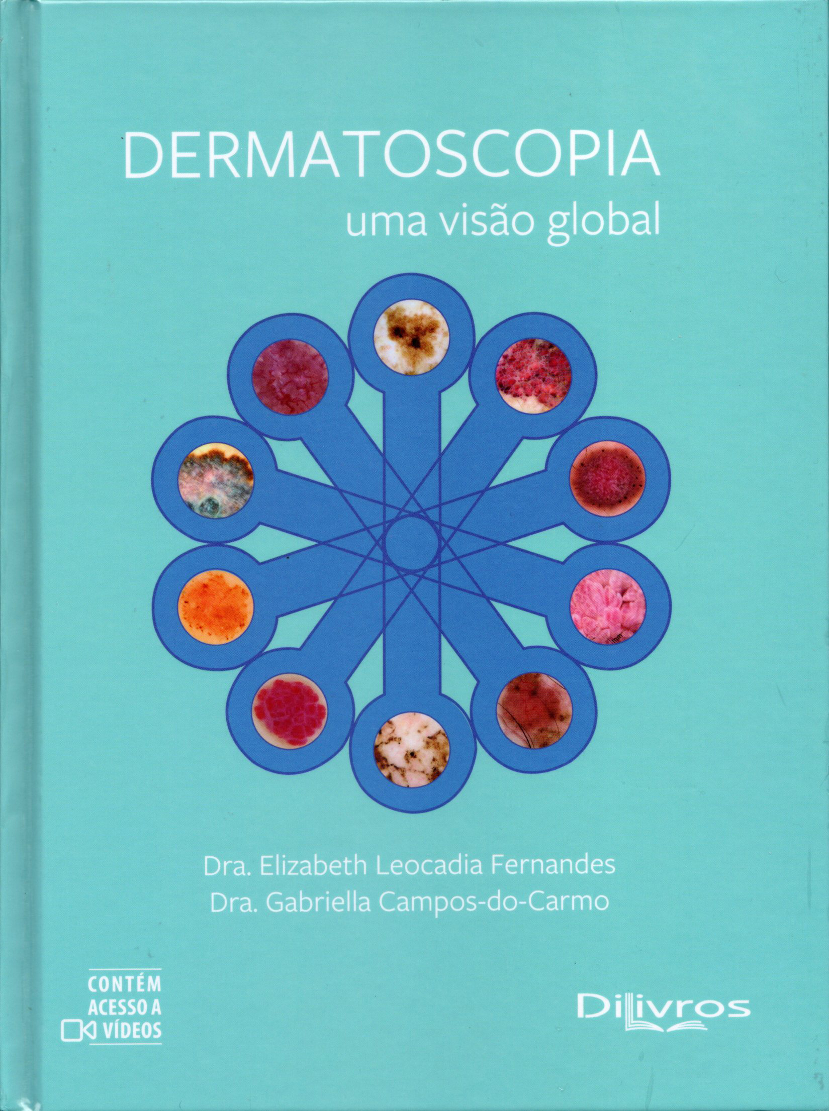 Dermatoscopia - uma visão global